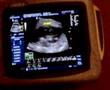 Our IVF twins ultrasound 13.5 weeks