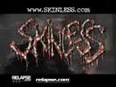 SUFFOCATION-SKINLESS