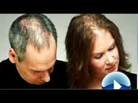 how to recover hair loss