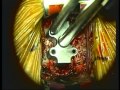 Cervical Arthroplasty With the Prestige LP Cervical Disc