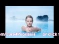 How to Beat Psoriasis - Know the Cause First