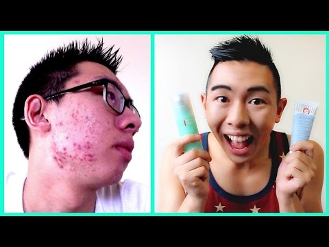 how to get rid of plan b acne