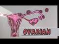 Ectopic Pregnancy Ectopic Pregnancy