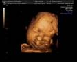 Ecografia-3D-David-M