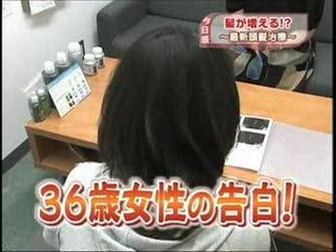 薄毛に悩む女性が多いそうですYoutube(ユーチューブ・ゆーちゅーぶ)・Dailymotion動画