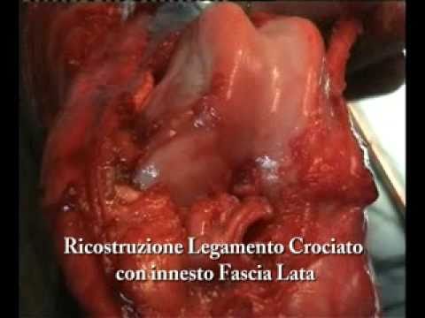 Immagine anteprima YouTube