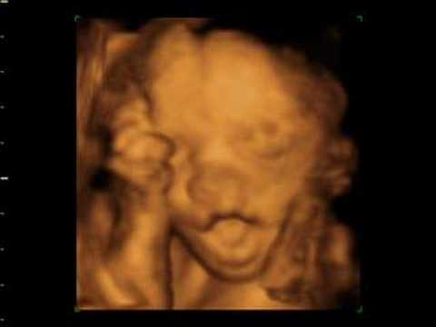 simon scans