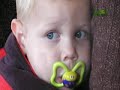 When Animals Strike - Coyote Attacks Boy