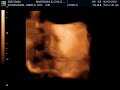 Baby Girl Schreuder Baby Girl Schreuder