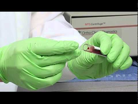 how to perform a manual rbc count