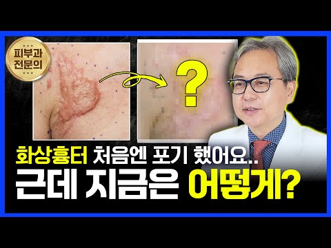 연세스타피부과 TV