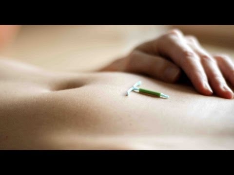 how to treat iud infection