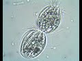 Euplotes Division - A Story from Subotica WWTP