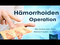 The Best 20 Hämorrhoiden Operationsmethoden