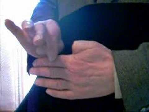 Miniaturka - Oderwanie kciuka od ręki