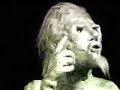 lobotomy.html