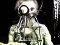 Lobotomy
