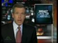 HEALTH CARE: Mammogram Screening