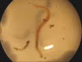 dance of a ringed worm (annelid)