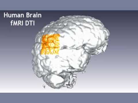Human Brain Magnetic Resonance / ...