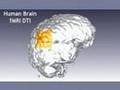 Human Brain Magnetic Resonance / Diffusion Tensor Imaging