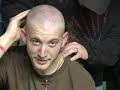 Going Bald Going Bald