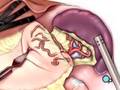 PreOp-Patient-Educat