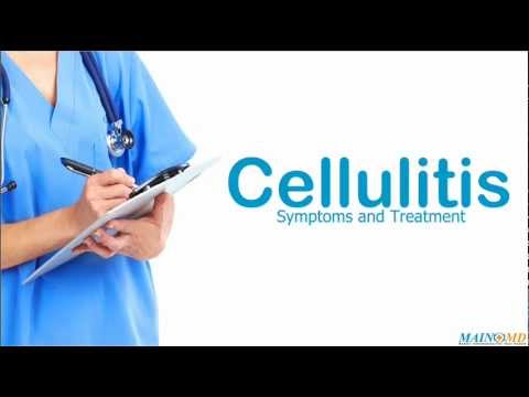 how to treat cellulitis