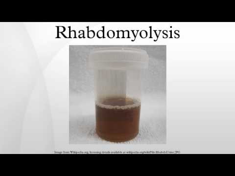 how to cure rhabdomyolysis