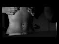 Bulimia
