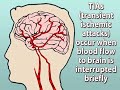 Seizures can be scary, but they are often manageable once diagnosed, however, what if what you are experiencing isnt really a seizure? This video presents an overview of seizure imitators. Check out more at www.healthguru.com?YT