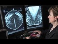 Innovations In Breast Cancer Detection: 3D Mammography