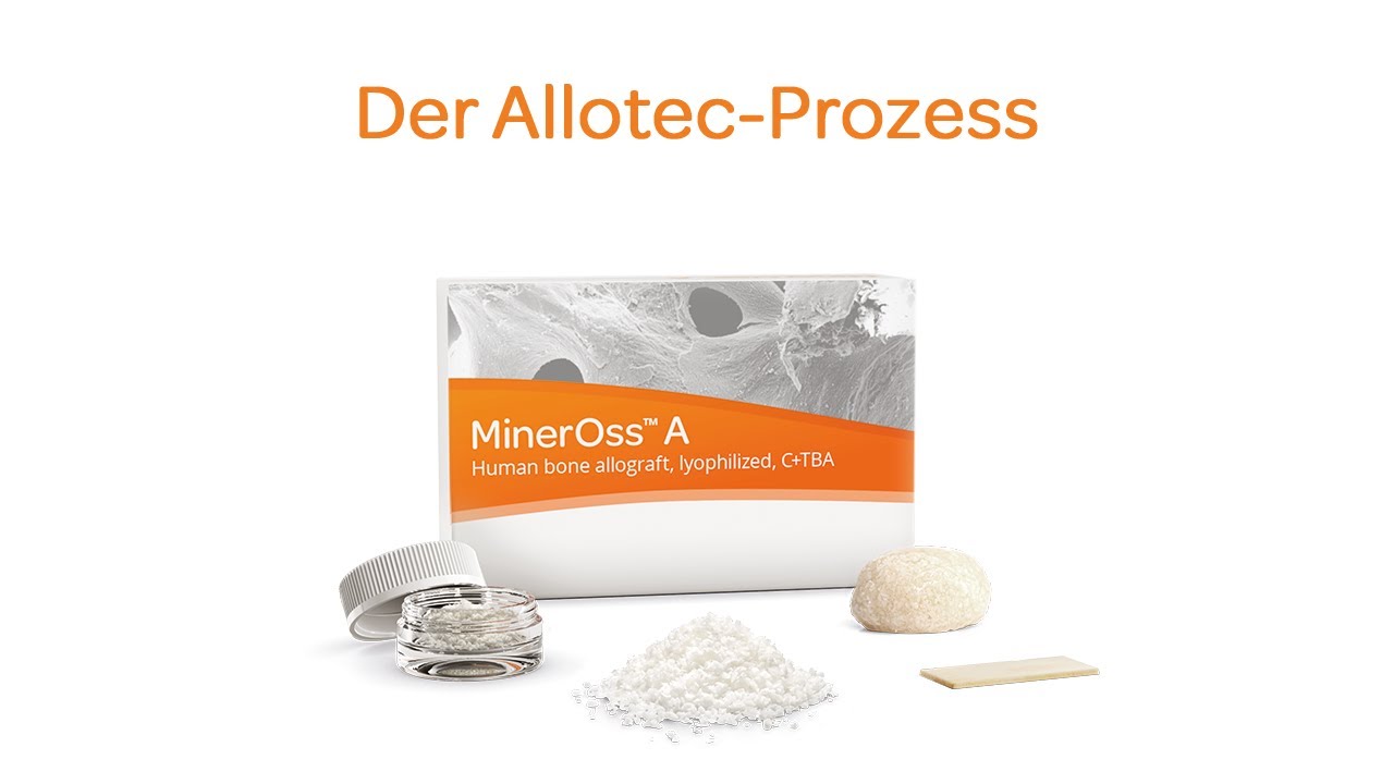 MinerOss® A | Die allogene Alternative zu autologen Transplantaten