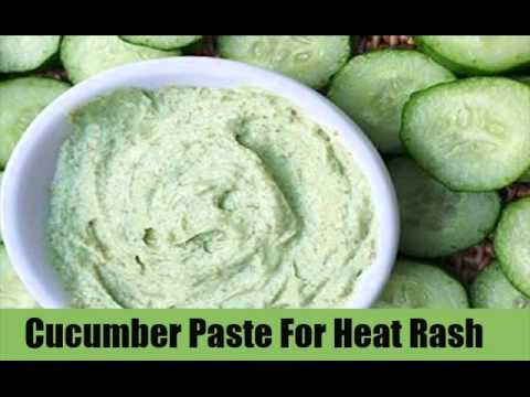 how to treat heat rash