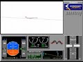 CAIXA PRETA - EMBRAER 145 SBCT