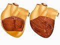 How the Body Works : The Heart