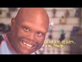 Down syndrome:&nbsp;S�ndrome de Down: Lucas