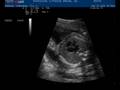 videos de BREZNAU STEPHANIE 20081120172339 1726030