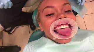 GOT A BAG & FIXED MY TEETH! (MIAMI VLOG)