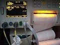 Aidan Heart Beat