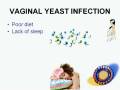 Fishy Vaginal Odor / Bad Vagina Smell / Vaginal Yeast Infection