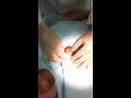 Cyst Gone Bad!.....Cut Me Mick!!