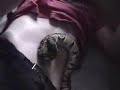 snake bite
