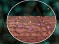Metabolic Syndrome