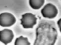 Listeria monocytogenes