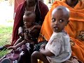 MSF Treating Thousands of Malnourished Children in Ethiopia