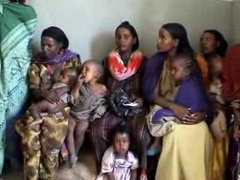 how to treat a child with kwashiorkor