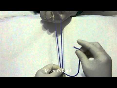 Mishra Knot - Extra Corporeal Knot by Dr. R.K. Mishra HD Video