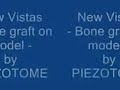 Presentation of an ultrasonic surgical device Presentation of an ultrasonic surgical device