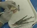 Presentation of an ultrasonic surgical device